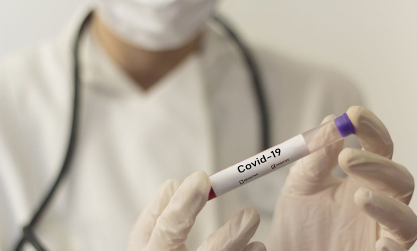 Coronavirus: 219 personas murieron y reportaron 10.409 nuevos casos en el país