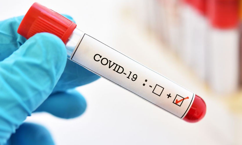 Suman 159 las víctimas fatales y 3.288 los infectados por coronavirus en el país