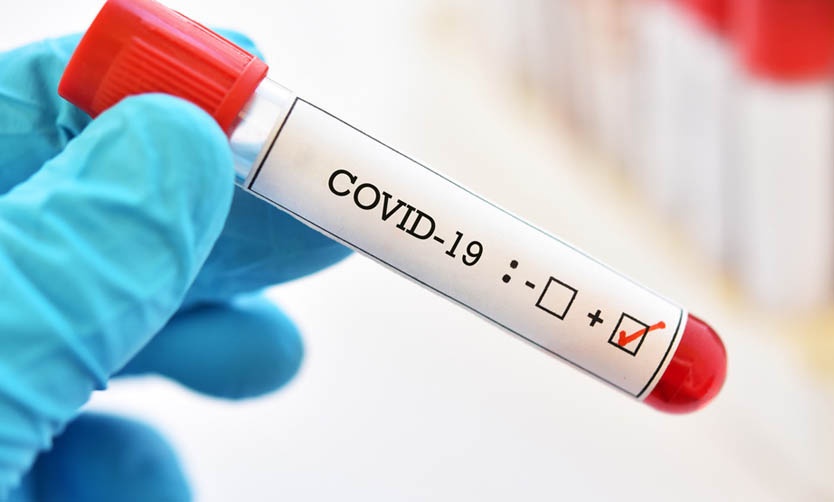 COVID en el país: Reportan 166 nuevas muertes y 4.824 contagios en las últimas 24 horas