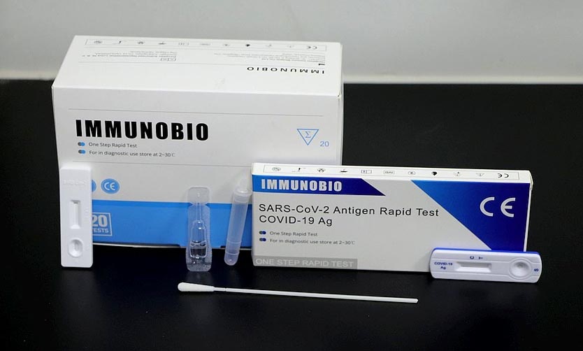 Prohíben la venta en farmacias de pruebas para detectar el coronavirus