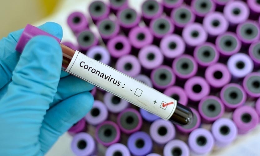 Ascienden a 452 los fallecidos y a 12.076 los positivos de coronavirus en Argentina