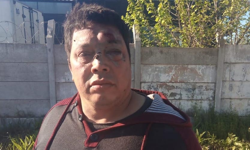 Golpearon a un empleado municipal y vecinos hicieron un piquete para defenderlo