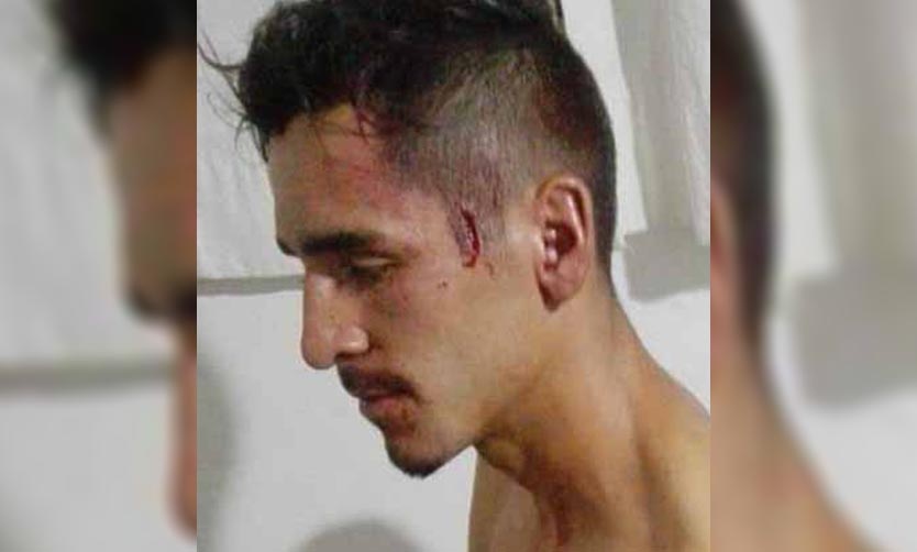 VIDEO - Batalla campal tras partido de fútbol: un herido de arma blanca